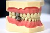 magnetic jaw lock.jpg